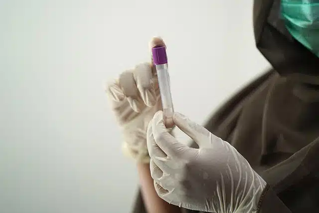 Prueba de VPH Salud Digna