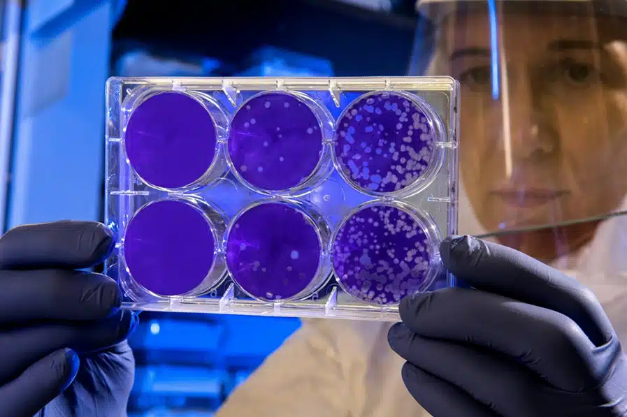 Interpretar los Resultados de Prueba de ADN en Salud Digna
