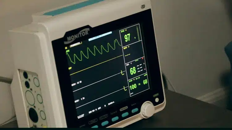 prueba de Electrocardiograma