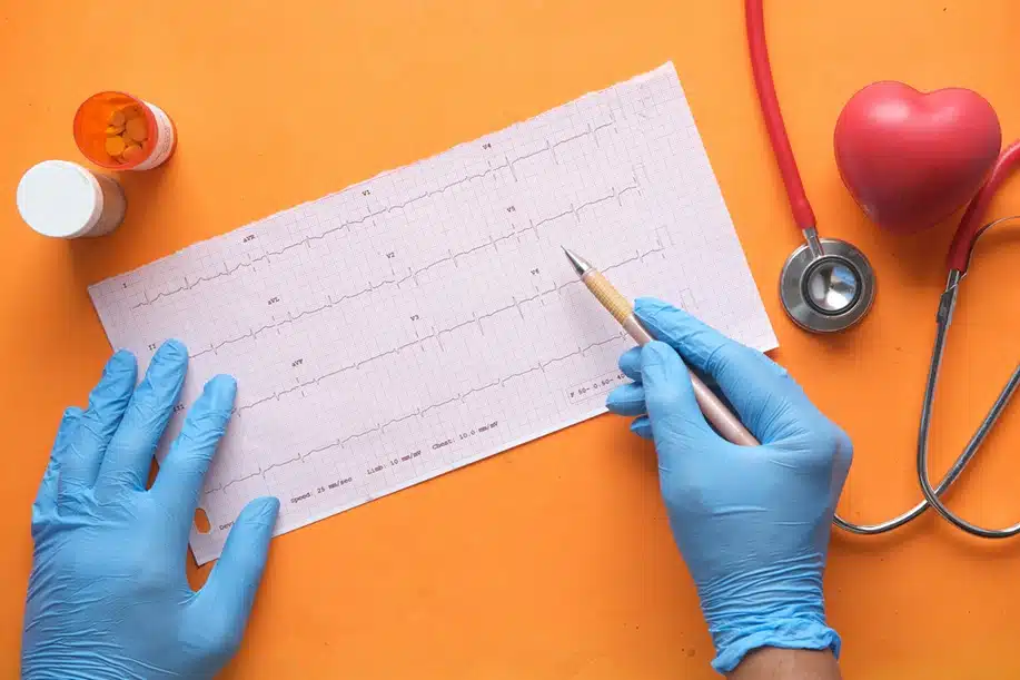 Ultrasonido en Salud Digna Resultados de tu Electrocardiograma en Salud Digna
